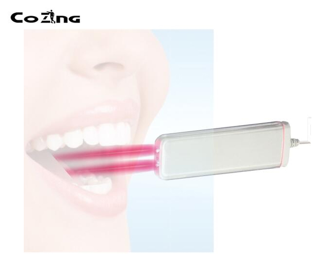 Produit de soins de santé 650nm Bio Laser Interface USB Ulcère de la bouche Throat/Oral Ulcer Treatment Laser Device