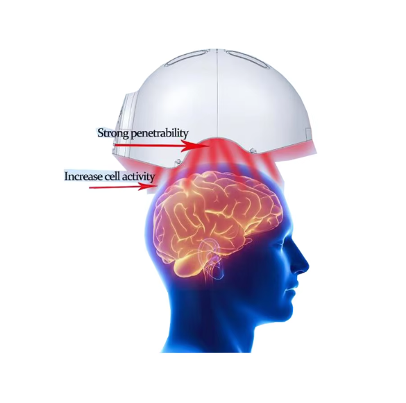 transcranial photobiomodulation